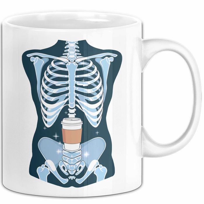 Radiologe Tasse Geschenk Lustige Geschenkidee Spruch Für Bildgebungs Profis Weiß Trendation