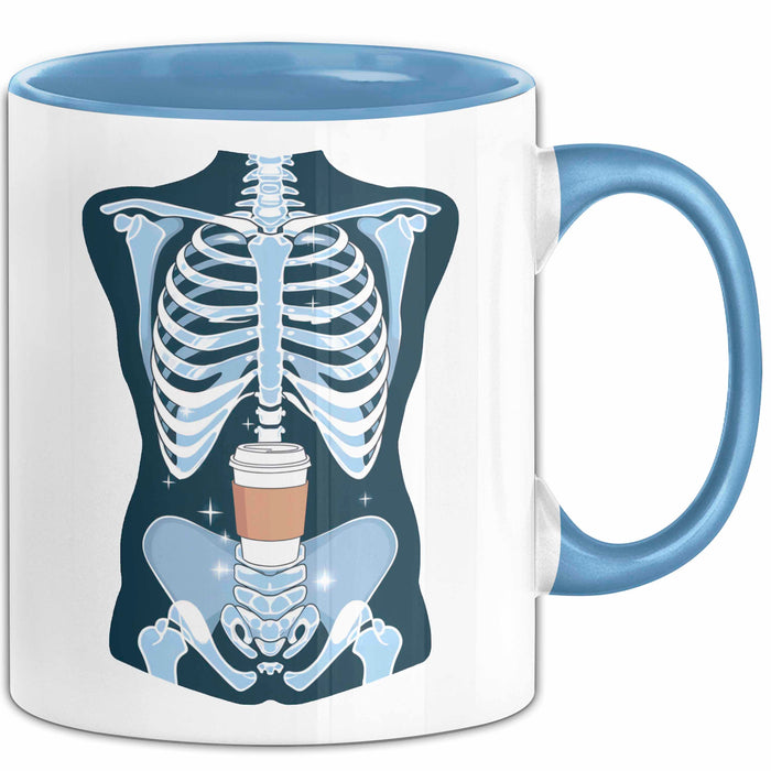 Radiologe Tasse Geschenk Lustige Geschenkidee Spruch Für Bildgebungs Profis Blau Trendation