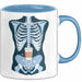Radiologe Tasse Geschenk Lustige Geschenkidee Spruch Für Bildgebungs Profis Blau Trendation